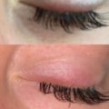 How do you stop an allergic reaction from eyelash extensions?