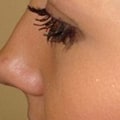 Will eyelashes grow back if pulled out from the root?