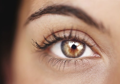 How do you get rid of a stye when you have lash extensions?
