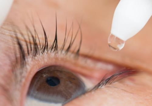How long does an allergic reaction to eyelash glue last?