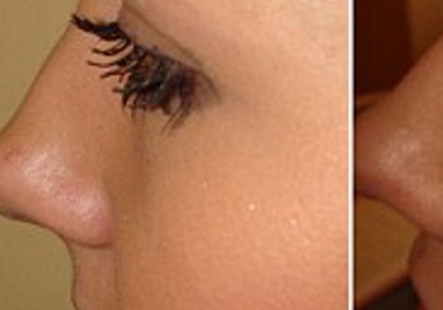 Will eyelashes grow back if pulled out from the root?